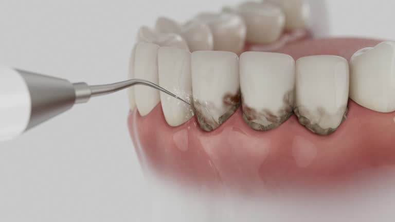 Reliable Root Canal Treatment contractor in Fleming County County, KY by Dentist Open Now